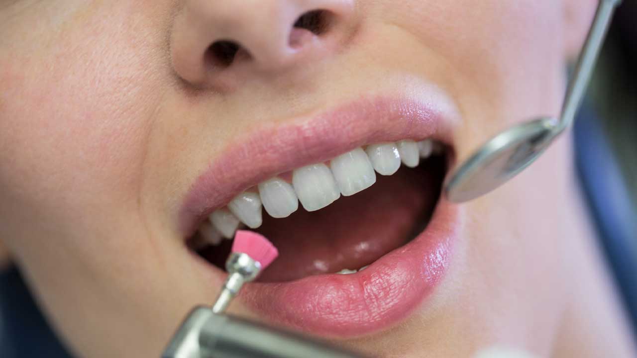 How Long Does A Dental Cleaning Take Breaking Down The Duration Of