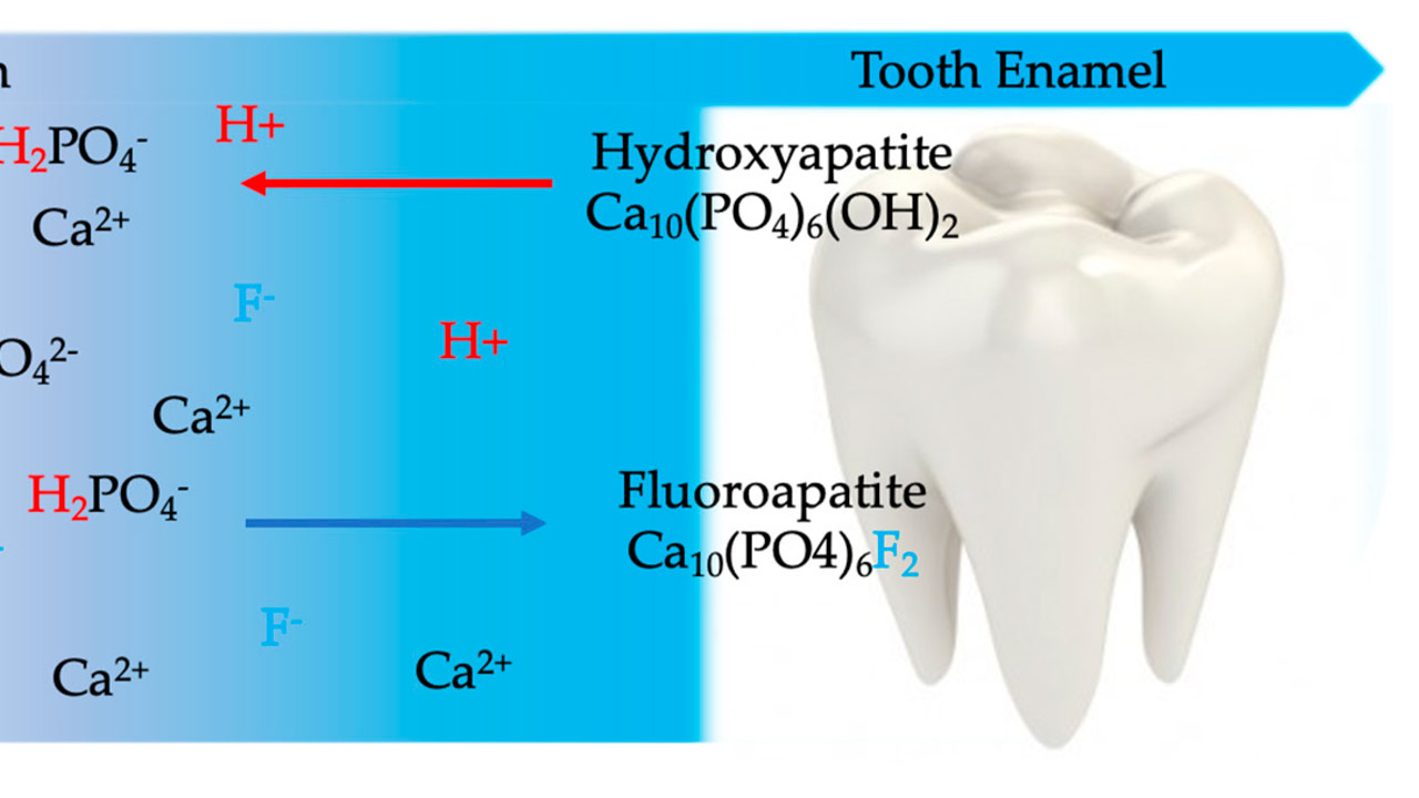 The Importance of Fluoride for Dental Health