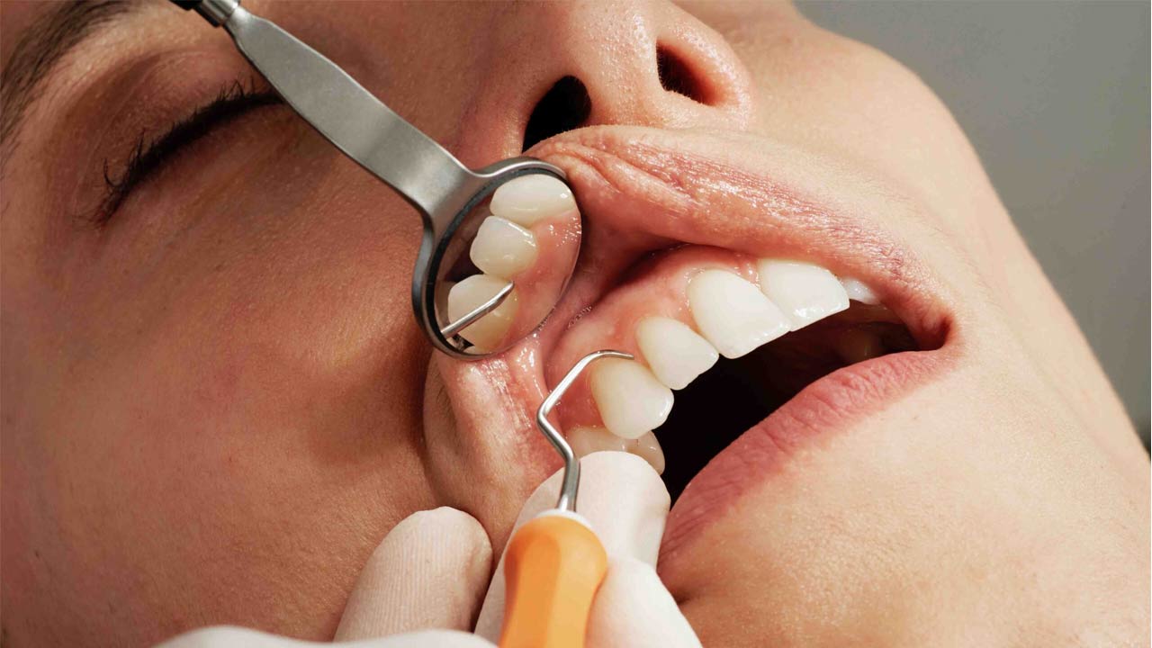 The Different Types of Dental Procedures Explained