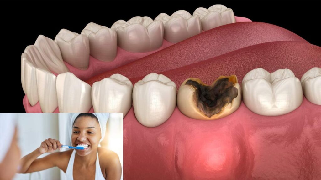 Can You Restore Tooth Health
