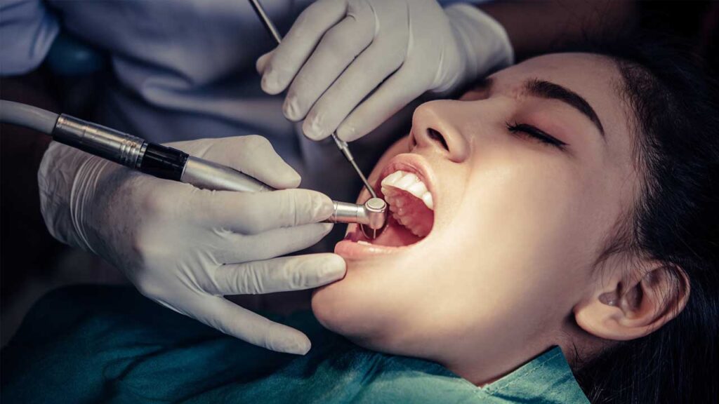 Dental Implants What You Need to Know