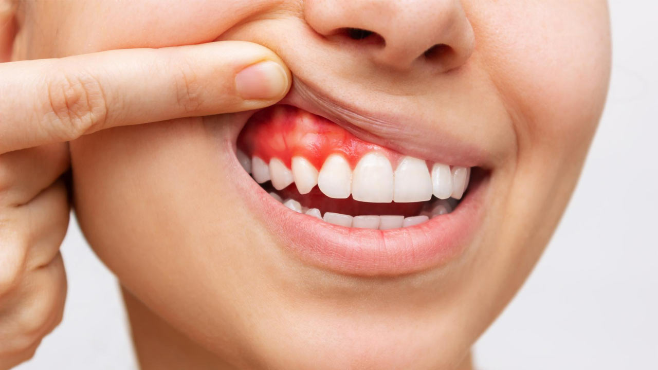 How Can I Make My Gums Stronger?