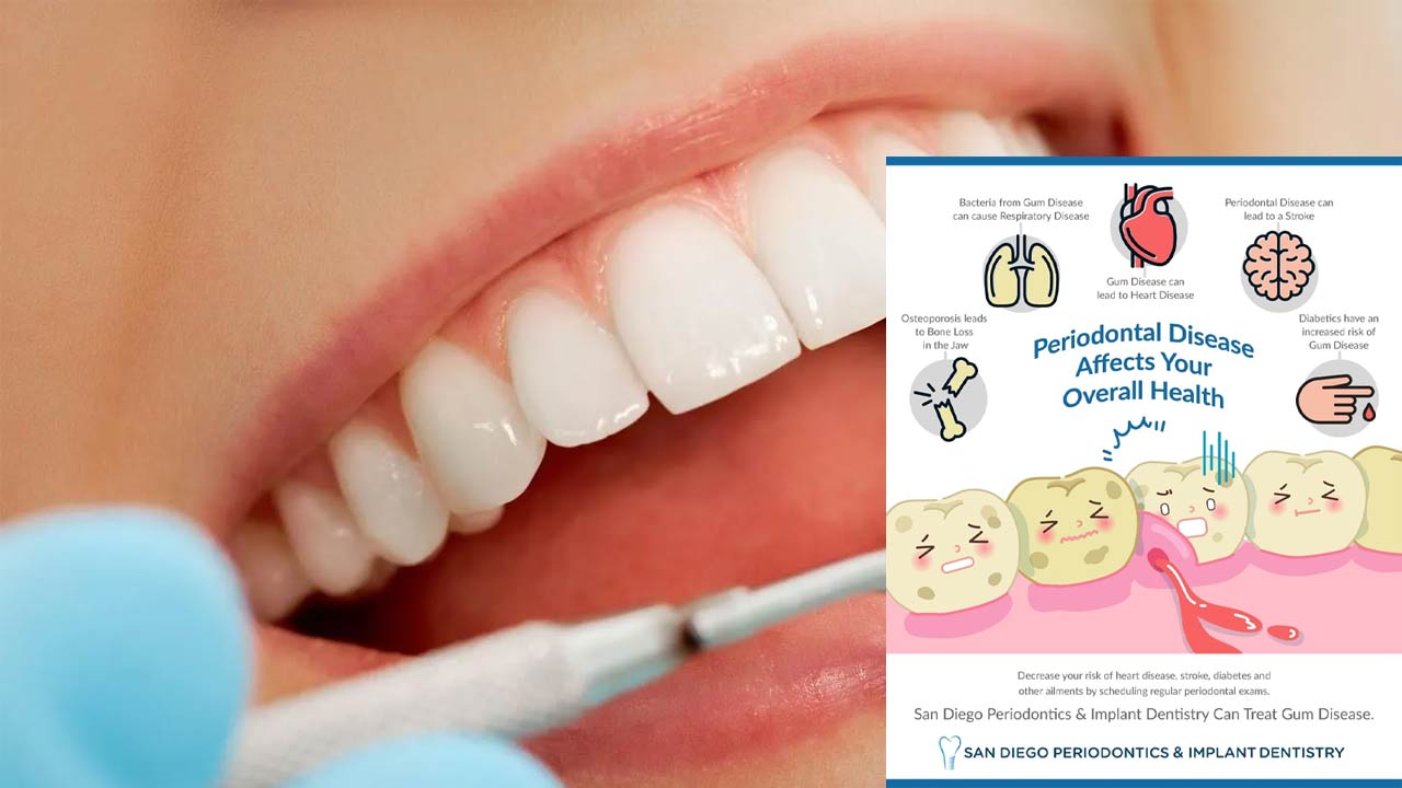 How Does Poor Dental Health Affect the Body?