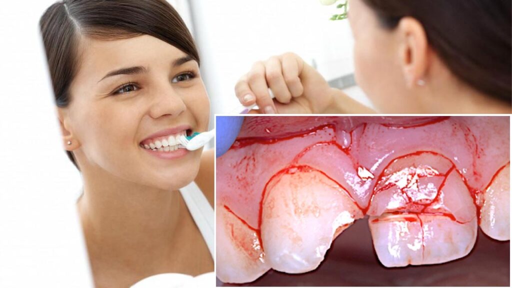 How to Care for Your Teeth After a Dental Injury