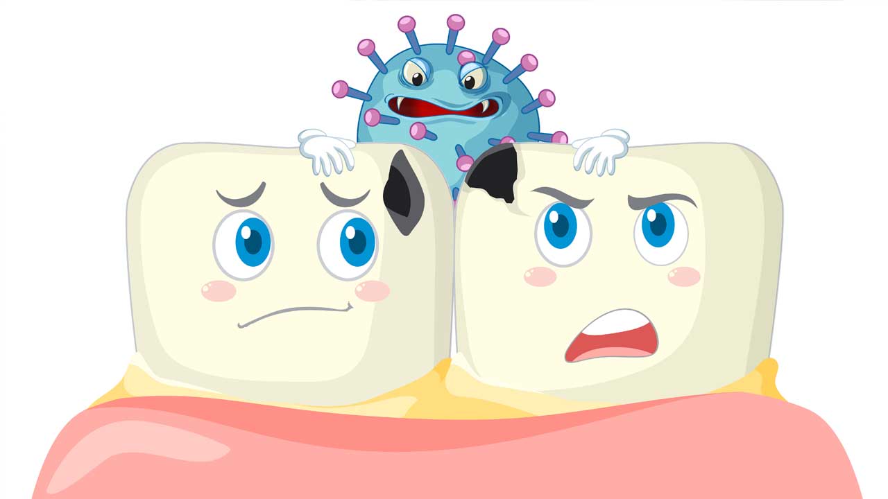 How to Prevent and Treat Tooth Decay