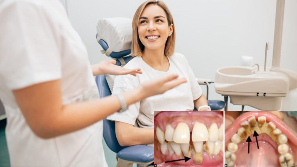The Importance of Dental Care for People with Autoimmune Diseases