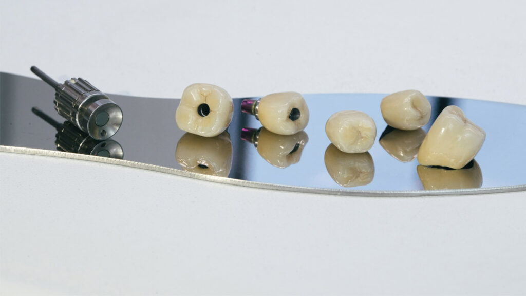 The Different Types of Dental Scaling and Root Planing