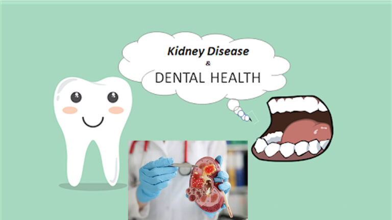 The Connection Between Dental Health and Kidney Disease