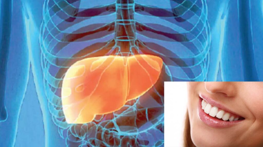 The Connection Between Dental Health and Liver Disease