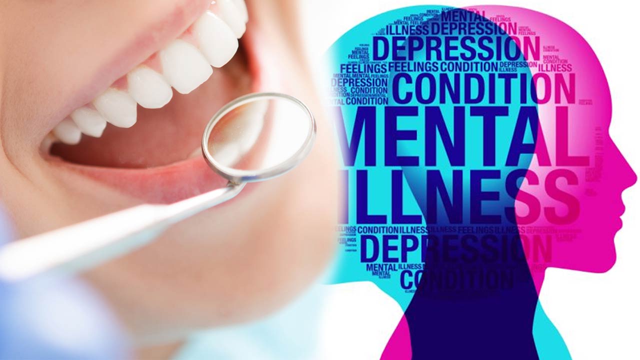 The Connection Between Dental Health and Mental Health