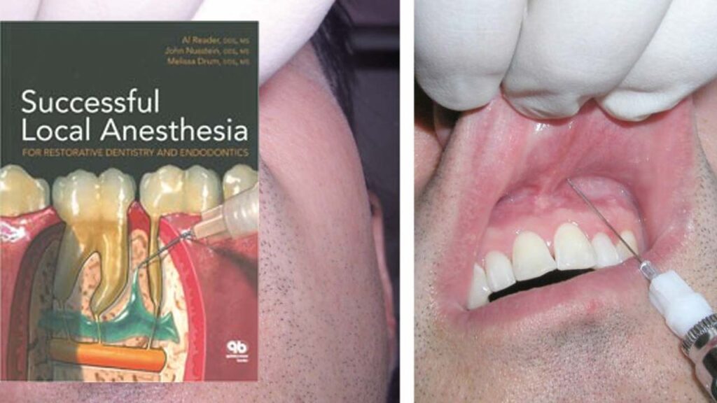 The Different Types of Dental Anaesthesia
