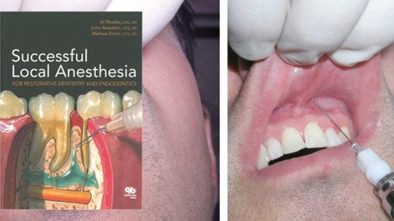 The Different Types Of Dental Anaesthesia - Dental Health