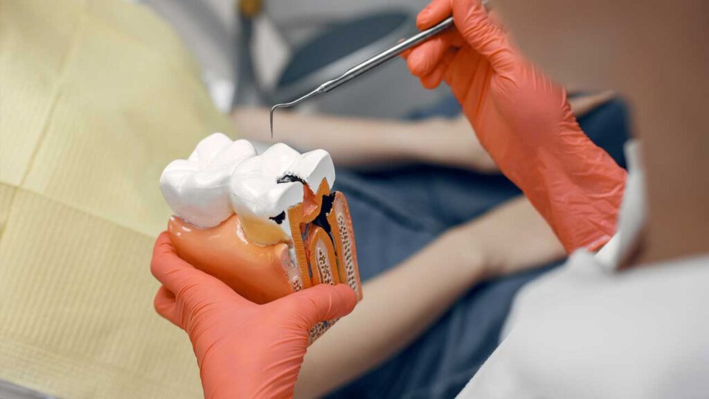 The Different [Types of Dental Fillings Explained](https://dentalhealthtime.com/the-different-types-of-dental-crowns-explained/
	)