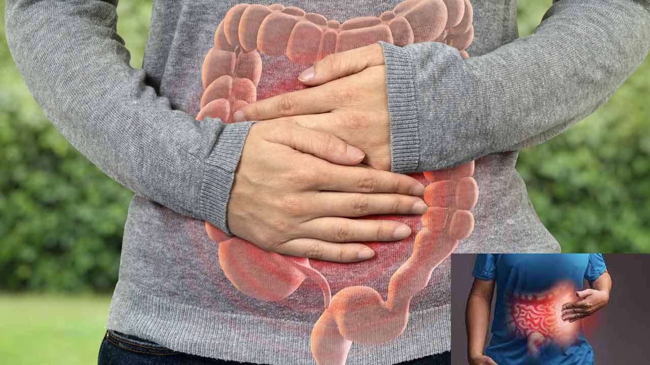 The Importance of Dental Care for People with Inflammatory Bowel Disease