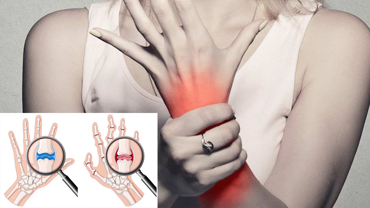 The Importance of Dental Care for People with Rheumatoid Arthritis