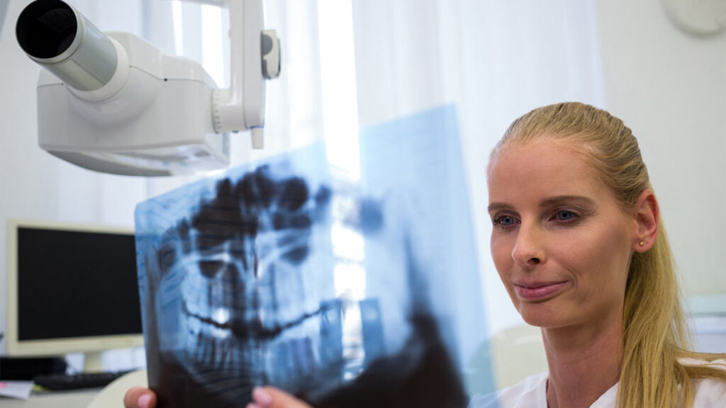 The Importance of Dental X-Rays