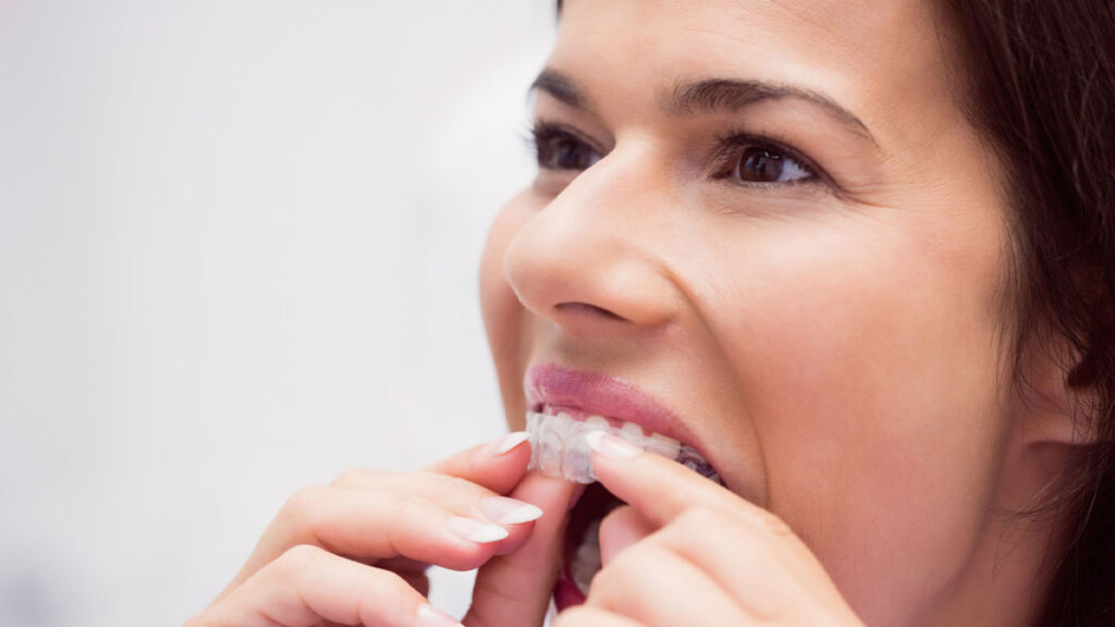The Pros and Cons of Dental Invisalign