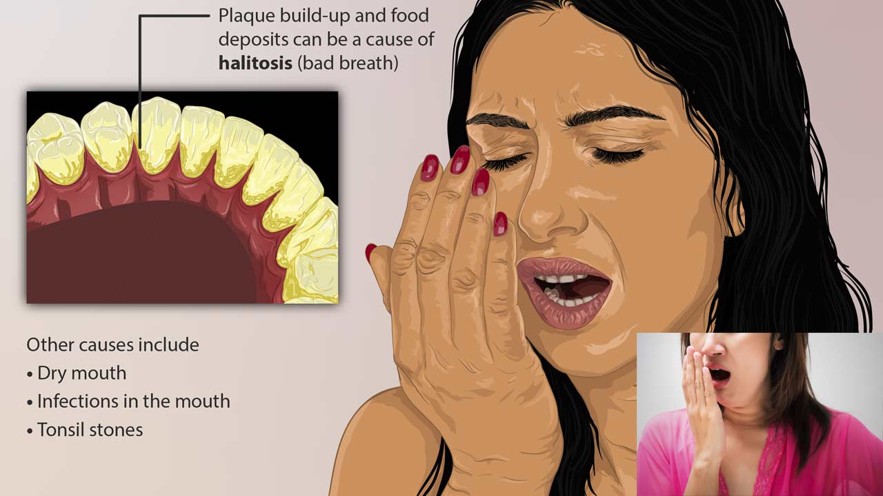 The Role of Dental Hygiene in Preventing Bad Breath