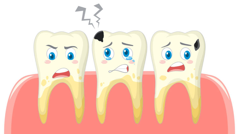The Role of Dental Hygiene in Preventing Tooth Decay