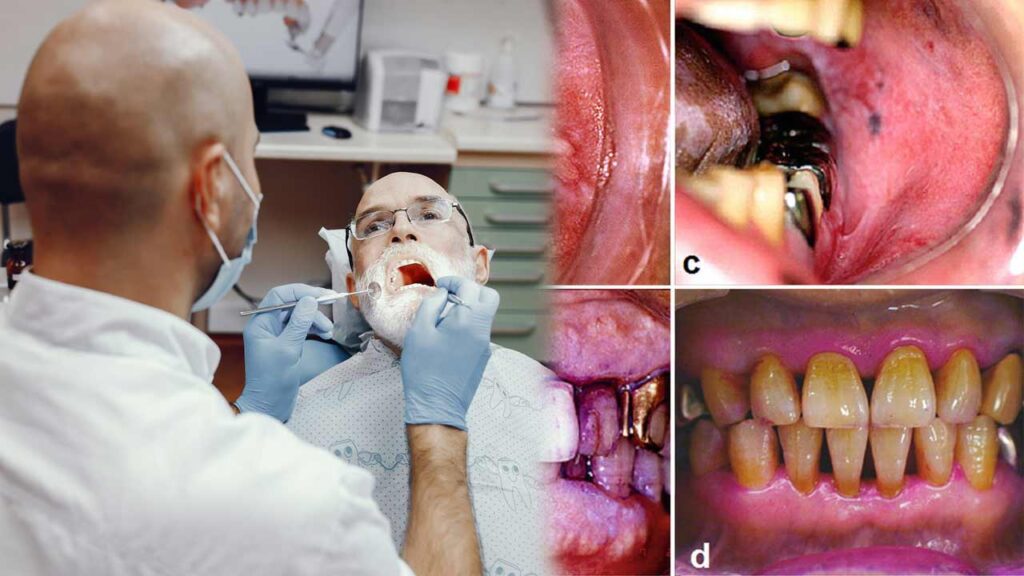 The Importance of Dental Check-Ups During Cancer Treatment