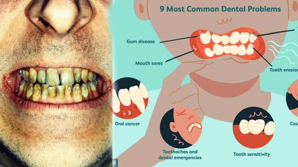 What Causes Poor Dental Health?