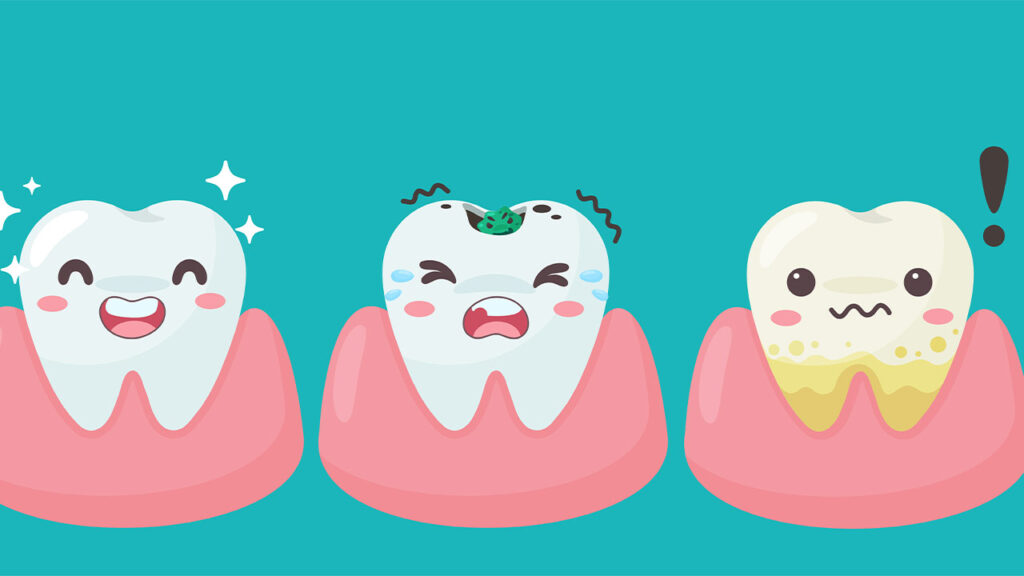 What are 3 problems related to teeth?