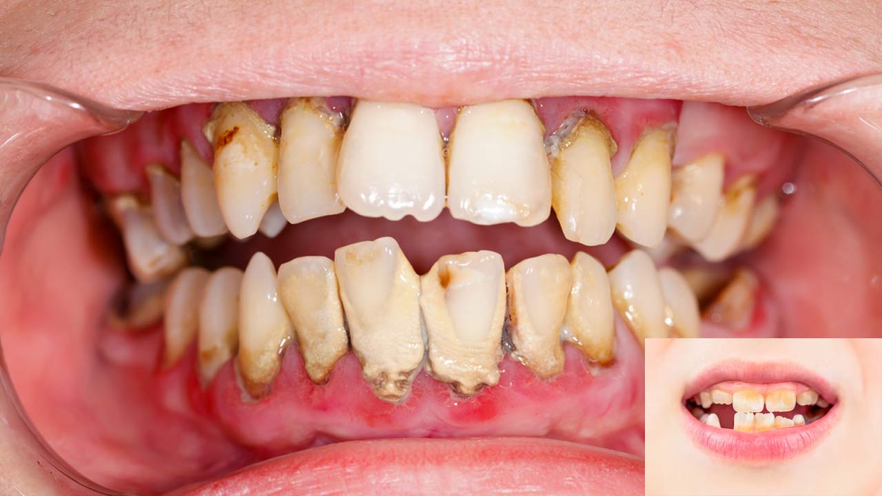 What are the signs of unhealthy teeth?