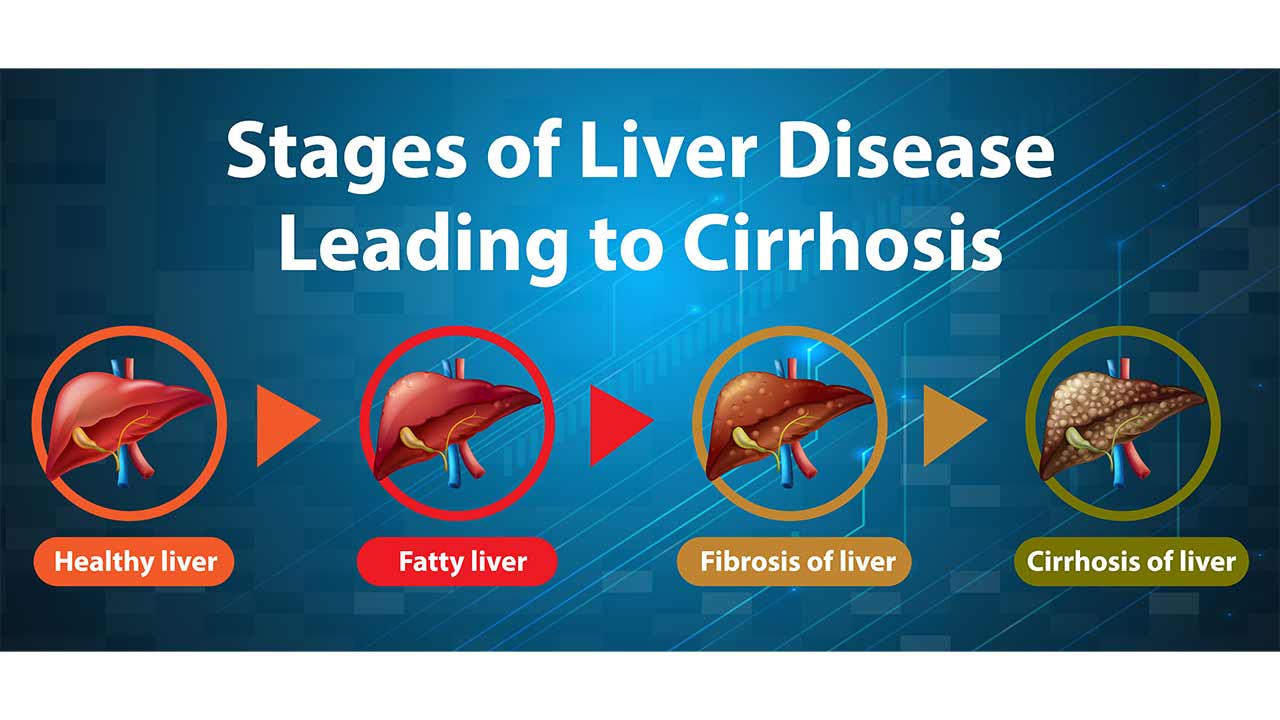 The Connection Between Dental Health and Liver Disease - Dental Health