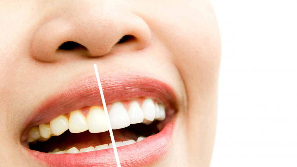 Which Vitamin is Good for Gums?