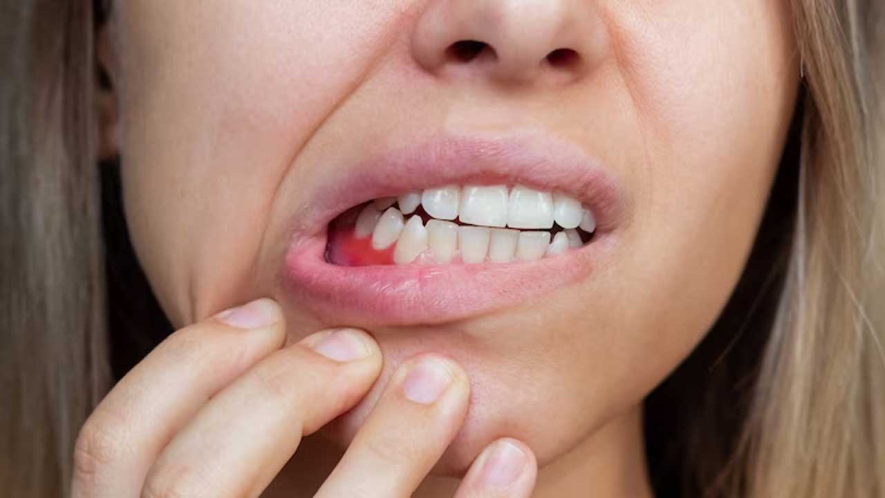 A Comprehensive Guide to Periodontal Gum Therapy Products