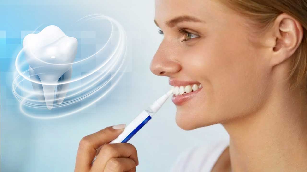 What is a Teeth Whitening Pen? How Does it Work?