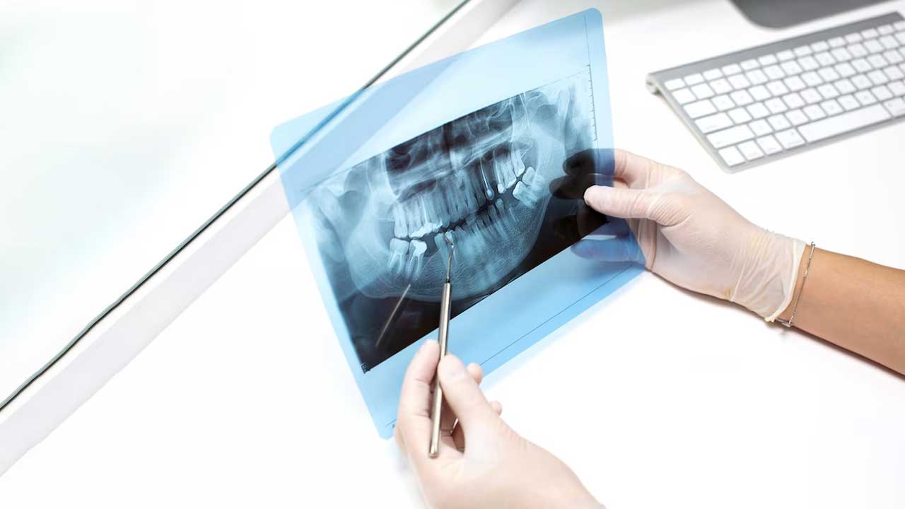 The Science Behind Dental Rubber Dams and Their Effectiveness