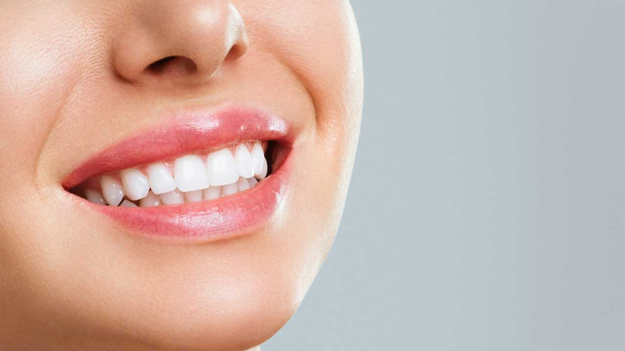 Natural Teeth Whitening Gels: Ingredients to Look for