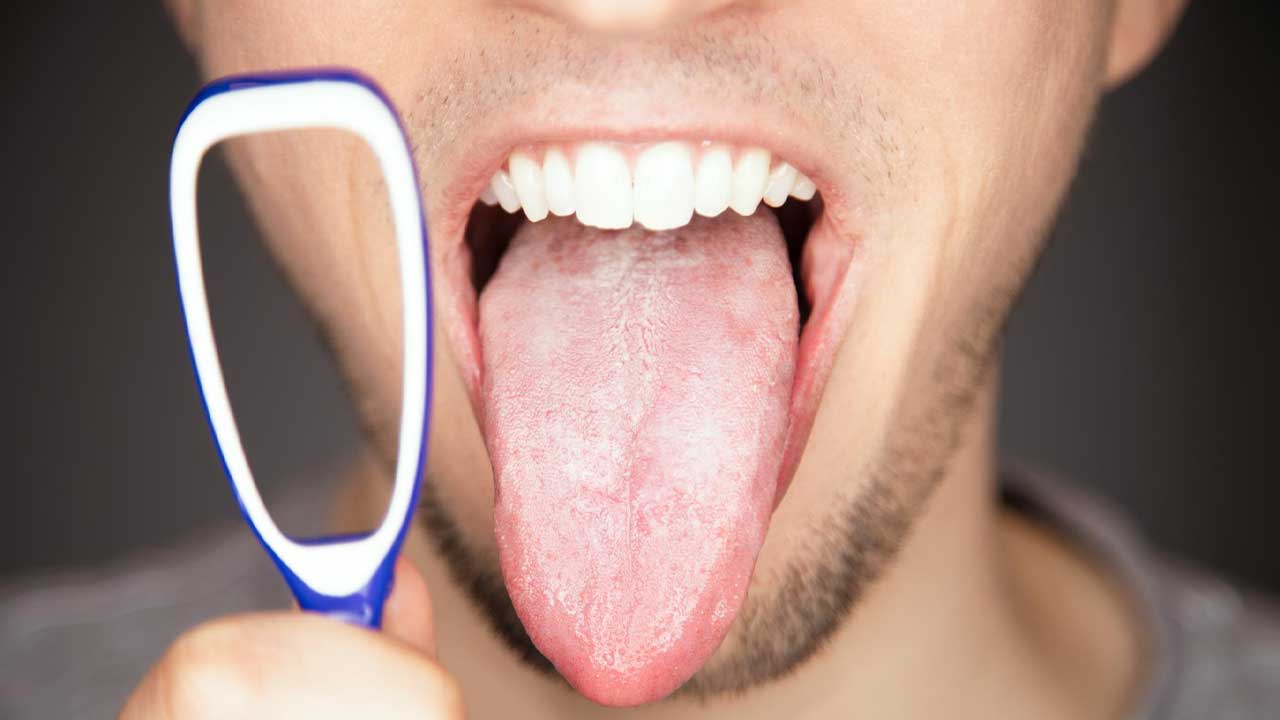 Why Tongue Scraping Should Be Part of Your Daily Routine