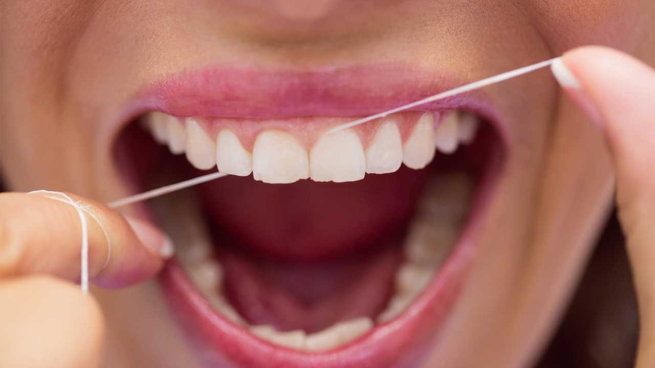 Beyond Cavities: The Surprising Effects of Not Flossing