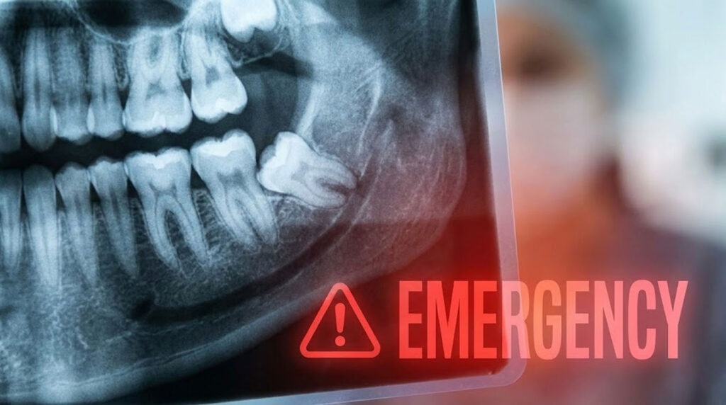 Dental X-ray showing teeth with an emergency alert symbol in red.