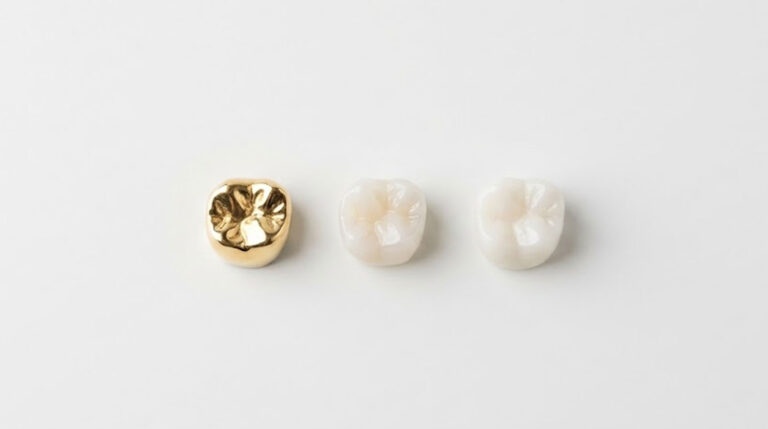 A gold dental crown and two white dental crowns on a light background.